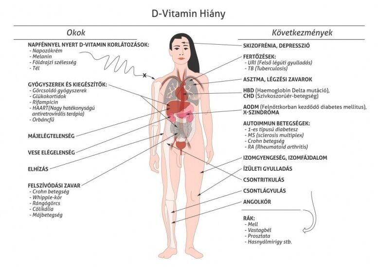 D-vitamin fontossága
